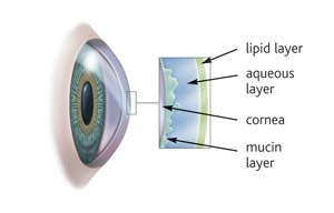 Dry Eye Syndrome Dry Eye Syndrome